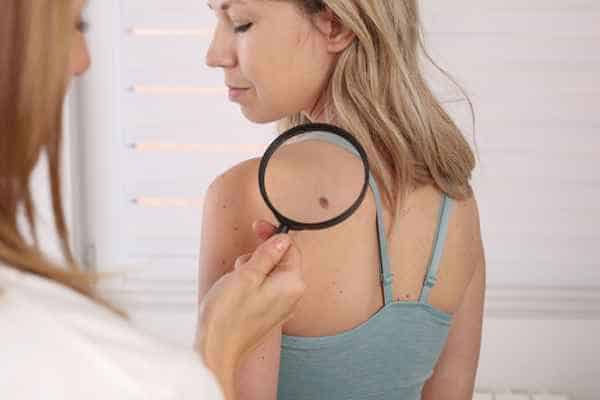 What Are Traditional Skin Lesion Removal Methods Greenwich?