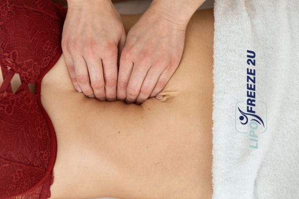 diastasis recti treatment Greenwich