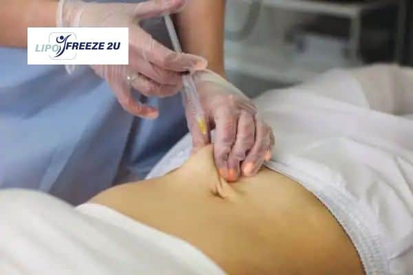 How Does Aqualyx Fat Dissolving Injection Work to Break Down Fat Greenwich?