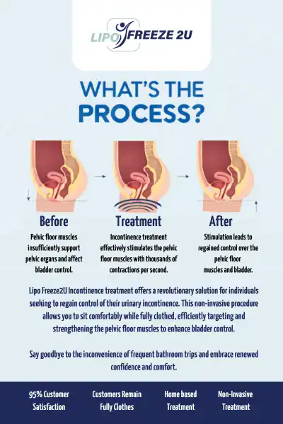 Diagram of how incontinence treatment Greenwich works.