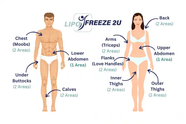 Areas you can have fat freezing treatment Greenwich