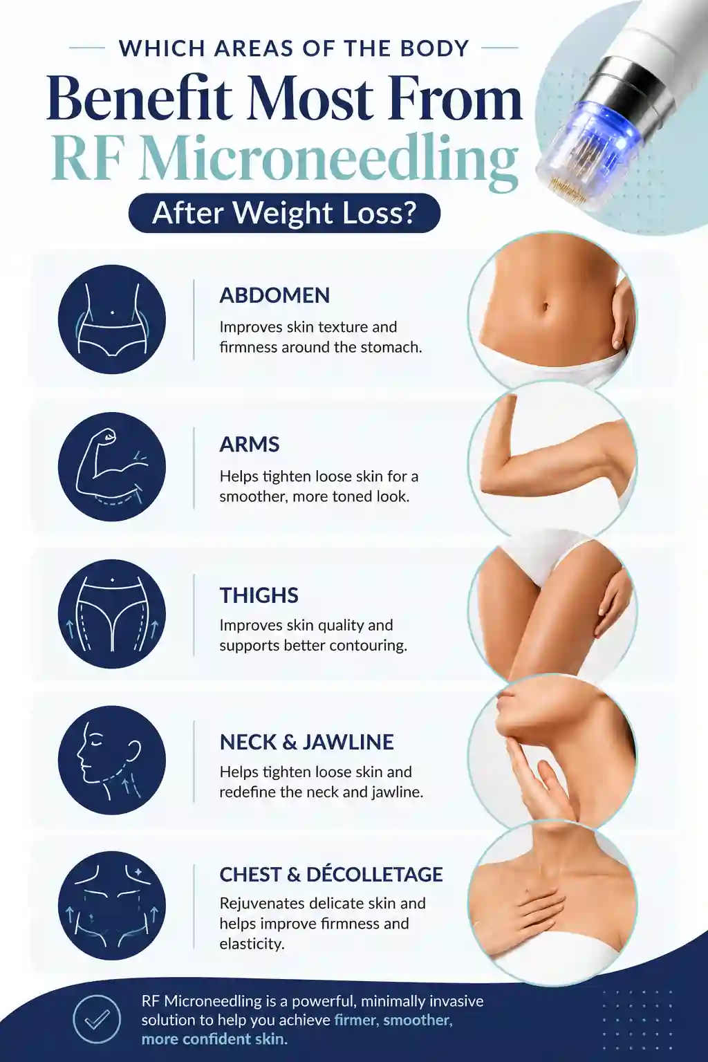 Which Areas of the Body Benefit Most From RF Microneedling After Weight Loss Greenwich